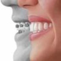 ortodonzia 3.jpg